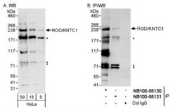 KNTC1 Antibody, Novus Biologicals 0.1mL; Unlabeled:Antibodies, Polyclonal