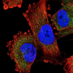 KPNA5 Antibody, Novus Biologicals 0.1mL; Unlabeled:Antibodies, Polyclonal