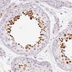 KPNA5 Antibody, Novus Biologicals 0.1mL; Unlabeled:Antibodies, Polyclonal