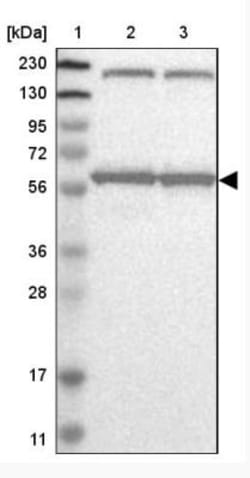 KPNA6 Antibody, Novus Biologicals 0.1mL; Unlabeled:Antibodies, Polyclonal