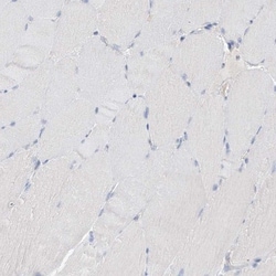 KPRP Antibody, Novus Biologicals 0.1mL; Unlabeled:Antibodies, Polyclonal