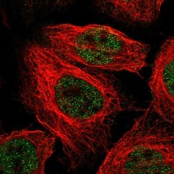 KRBA2 Antibody, Novus Biologicals 0.1mL; Unlabeled:Antibodies, Polyclonal