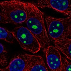 KRI1 Antibody, Novus Biologicals 0.1mL; Unlabeled:Antibodies, Polyclonal