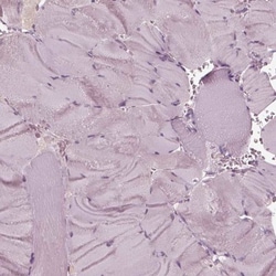 KRT6L Antibody, Novus Biologicals 25 &mu;L, Unlabeled:Antibodies, Polyclonal