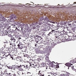 KRT6L Antibody, Novus Biologicals 25 &mu;L, Unlabeled:Antibodies, Polyclonal