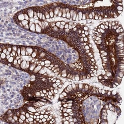 KRTCAP3 Antibody, Novus Biologicals 0.1mL; Unlabeled:Antibodies, Polyclonal