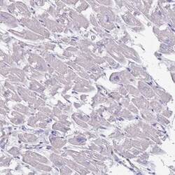 KRTCAP3 Antibody, Novus Biologicals 0.1mL; Unlabeled:Antibodies, Polyclonal