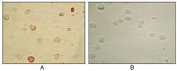 KSHV ORF45 Antibody (2D4A5), Novus Biologicals:Antibodies:Primary Antibodies