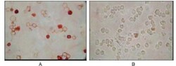KSHV ORF62 Antibody (5B7B6), Novus Biologicals 0.1mL; Unlabeled:Antibodies,