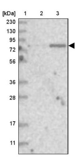 KY Antibody, Novus Biologicals 0.1mL; Unlabeled:Antibodies, Polyclonal