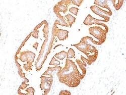 Kallikrein 3/PSA Antibody (KLK3/801), Novus Biologicals 0.2mg; Unlabeled:Antibodies,