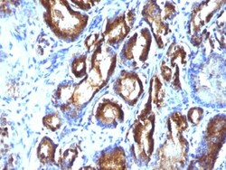 Kallikrein 3/PSA Antibody (KLK3/801 + KLK3/1248), Novus Biologicals 0.2mg;