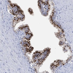 Kallikrein 4/Prostase/EMSP1 Antibody, Novus Biologicals:Antibodies:Primary
