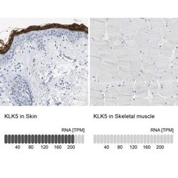 Kallikrein 5 Antibody, Novus Biologicals 25 &mu;L | Buy Online | Novus Biologicals | Fisher Scientific