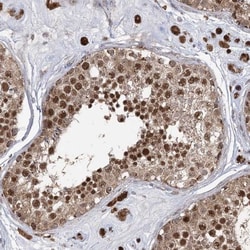 Kanadaptin Antibody, Novus Biologicals:Antibodies:Primary Antibodies
