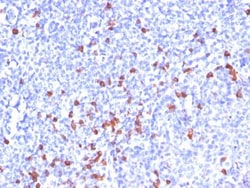 Kappa Light Chain Antibody (L1C1), Novus Biologicals 0.2mg; Unlabeled:Antibodies,