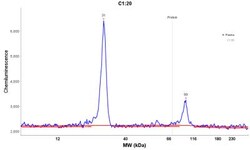 Kappa Light Chain Antibody (L1C1), Novus Biologicals 0.2mg; Unlabeled:Antibodies,