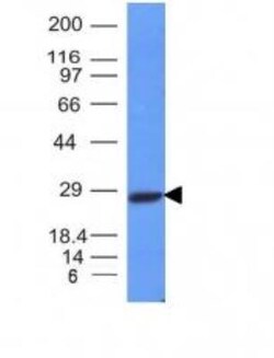 Kappa Light Chain Antibody (L1C1), Novus Biologicals 0.2mg; Unlabeled:Antibodies,