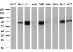 Keap1 Antibody (OTI1B4), Novus Biologicals 0.1mL; Unlabeled:Antibodies,