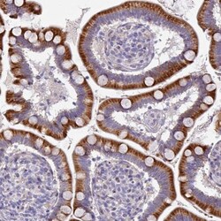 Kelch-Like 3 Antibody, Novus Biologicals 0.1mL; Unlabeled:Antibodies, Polyclonal