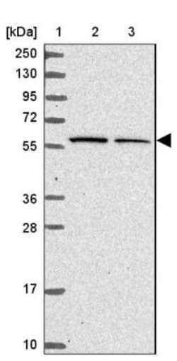 Kelch-Like 3 Antibody, Novus Biologicals 0.1mL; Unlabeled:Antibodies, Polyclonal