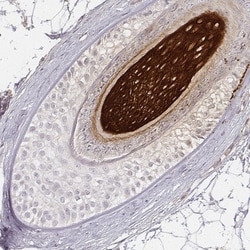 Keratin 31 Antibody, Novus Biologicals:Antibodies:Primary Antibodies