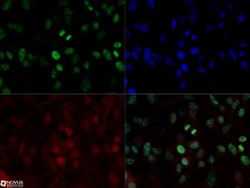 Ki67/MKI67 Antibody (8D5) - BSA Free, Novus Biologicals 0.1mL; Unlabeled:Antibodies,