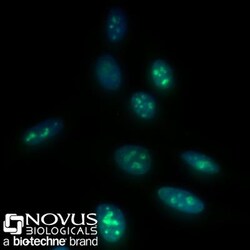 Ki67/MKI67 Antibody (8D5) - BSA Free, Novus Biologicals 0.1mL; Unlabeled:Antibodies,