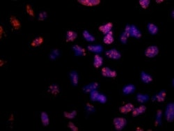 Ki67/MKI67 Antibody (8D5) - BSA Free, Novus Biologicals 0.1mL; Unlabeled:Antibodies,