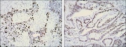 Ki67/MKI67 Antibody (8D5) - BSA Free, Novus Biologicals 0.1mL; Unlabeled:Antibodies,