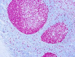 Ki67/MKI67 Antibody (SP6) - Unpurified, Novus Biologicals 0.5mL; Unlabeled:Antibodies,
