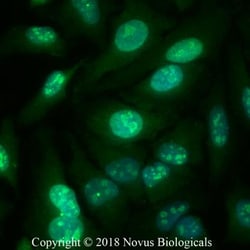 Ki67/MKI67 Antibody - BSA Free, Novus Biologicals:Antibodies:Primary Antibodies