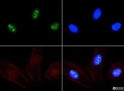 Ki67/MKI67 Antibody - BSA Free, Novus Biologicals:Antibodies:Primary Antibodies