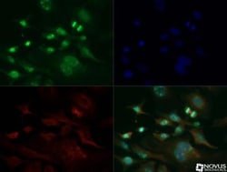 Ki67/MKI67 Antibody - BSA Free, Novus Biologicals:Antibodies:Primary Antibodies