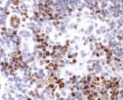 Ki67/MKI67 Antibody - BSA Free, Novus Biologicals:Antibodies:Primary Antibodies
