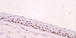 Ki67/MKI67 Antibody - BSA Free, Novus Biologicals:Antibodies:Primary Antibodies