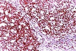 Ki67/MKI67 Antibody - BSA Free, Novus Biologicals:Antibodies:Primary Antibodies