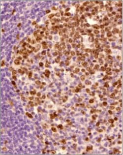 Ki67/MKI67 Antibody - BSA Free, Novus Biologicals:Antibodies:Primary Antibodies