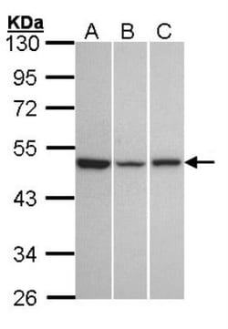 KiSS1R/GPR54 Antibody, Novus Biologicals 0.1mL; Unlabeled:Antibodies, Polyclonal