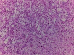Novus Biologicals&trade;&nbsp;Kidney Tissue Slides (Adult Normal)- Frozen