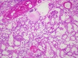 Novus Biologicals Kidney Tissue Slides (Hypertension)- Frozen 5 Slides | Buy Online | Novus Biologicals&trade; | Fisher Scientific