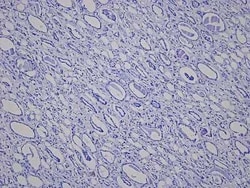 Novus Biologicals&trade;&nbsp;Kidney Tissue Slides (Lupus)- Paraffin