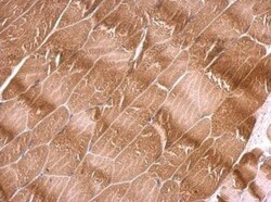 Kilon/NEGR1 Antibody, Novus Biologicals 0.1mL; Unlabeled:Antibodies, Polyclonal