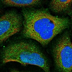 Kinesin 5C Antibody, Novus Biologicals 25 &mu;L; Unlabeled:Antibodies,