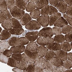Kinesin C2 Antibody, Novus Biologicals:Antibodies:Primary Antibodies