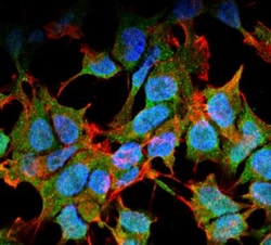 Kir6.1 Antibody (S366-60), Novus Biologicals 100&mu;g; Unlabeled:Antibodies,