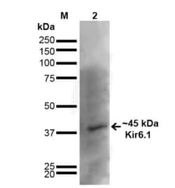 Kir6.1 Antibody (S366-60), Novus Biologicals 100&mu;g; Unlabeled:Antibodies,