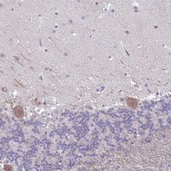 Kirrel3/NEPH2 Antibody, Novus Biologicals 25 &mu;L, Unlabeled:Antibodies,