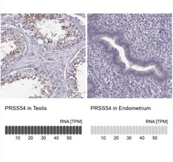 Klkbl4 Antibody, Novus Biologicals:Antibodies:Primary Antibodies