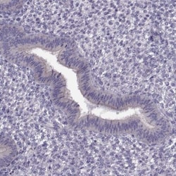 Klkbl4 Antibody, Novus Biologicals:Antibodies:Primary Antibodies